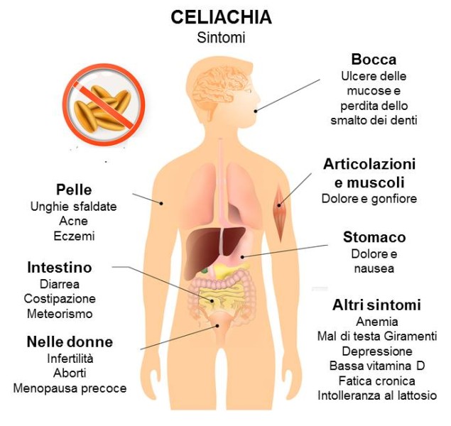 Sono celiaco o non lo sono?